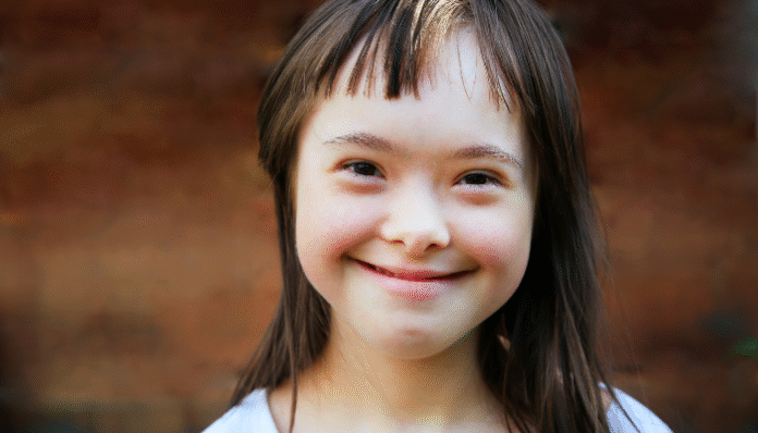 Ilustrasi Down Syndrome (foto canva)