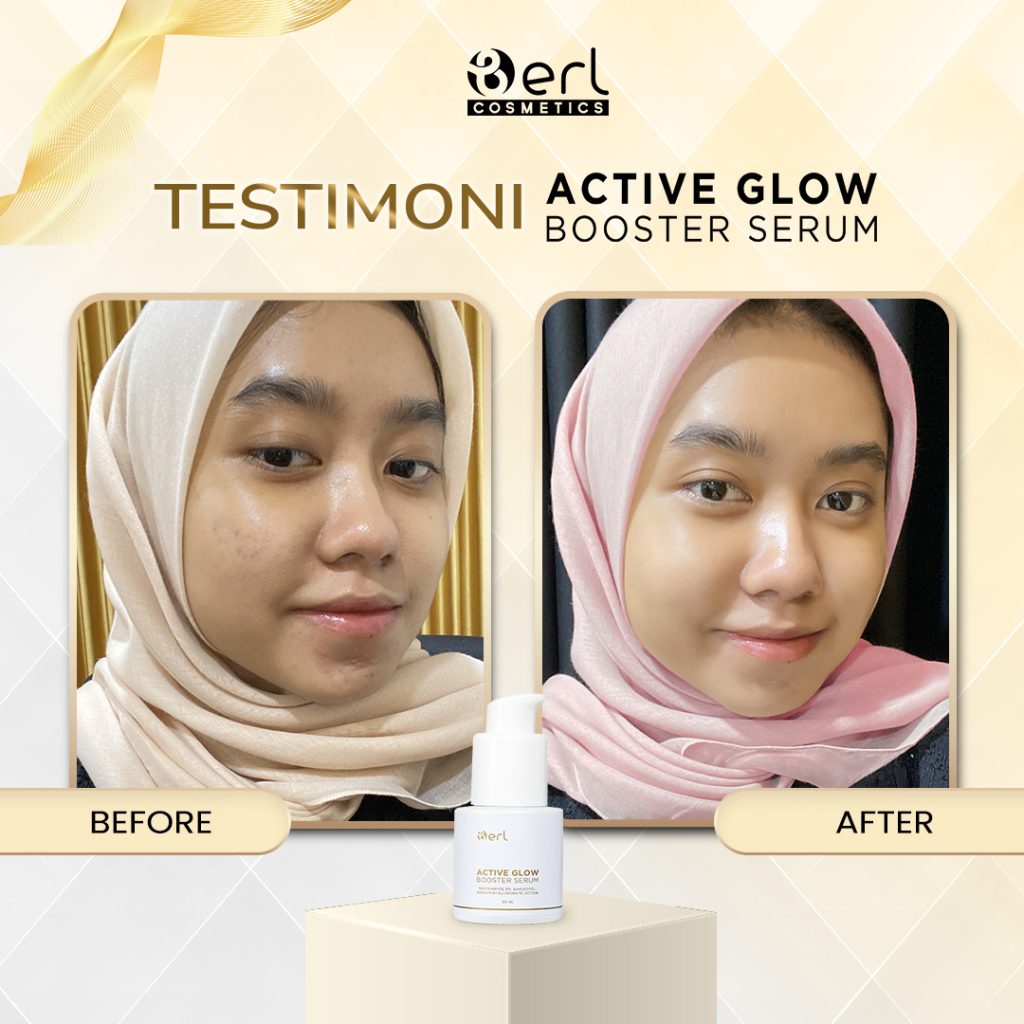 Testimoni AGB Active Glow Booster Serum